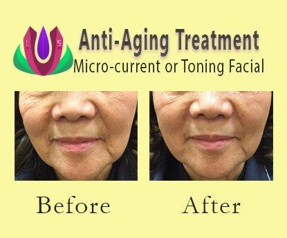 Anti-Aging Treatment - Microcurrent or Toning Facial to lift, tone, sagging complexion for female in late 50's.