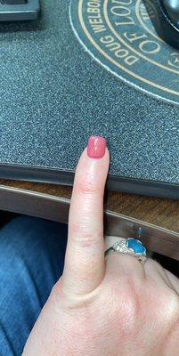 Crooked pinky nail