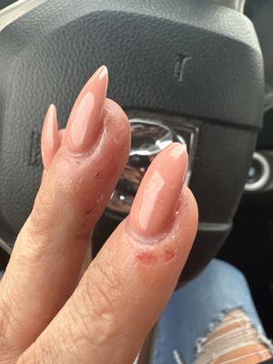 Cuticles