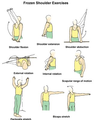 Frozen shoulder exercises