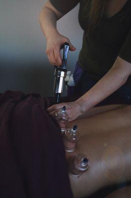 We offer cupping at no additional charge. Visit our website for more information about Cupping.