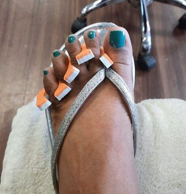 She called herself making my toenails even. What she did was file them down too short and crooked. Look at the 2nd and 3rd toenails!