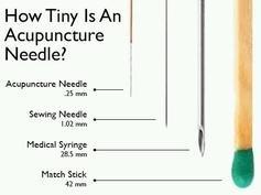 Size of Acupuncture needles