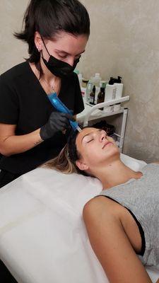 PRP microneedling facial