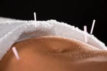 Acupuncture for weight loss