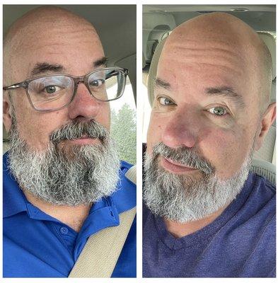 Bears Trim - Before and After