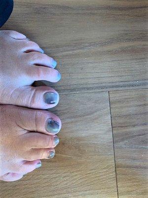 Pedicure with bad polish