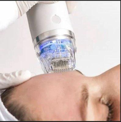 Micro needling/dermabrasion device.