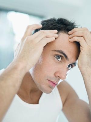 Hair loss services for men