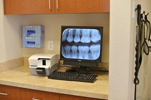 Digital x-rays at the Sandia Smiles Dental Center