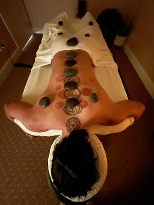 Massage enhancements -cupping, hot stones