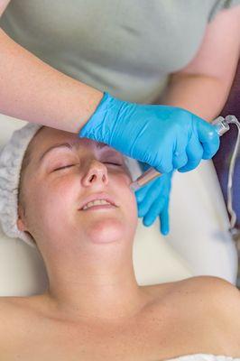 Rezenerate infusions allow a deeper penetration of product into your skin for super charged results!