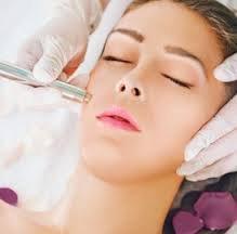 Microdermabrasion