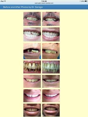 Before and after Dentistry by Dr. David Saraga