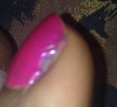 Side view of left big toe