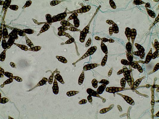 Alternaria