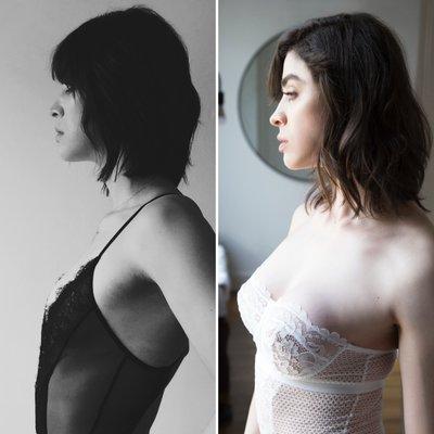 6 months post-op breast augmentation with