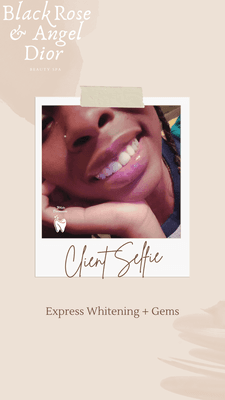 Express Whitening & Gems