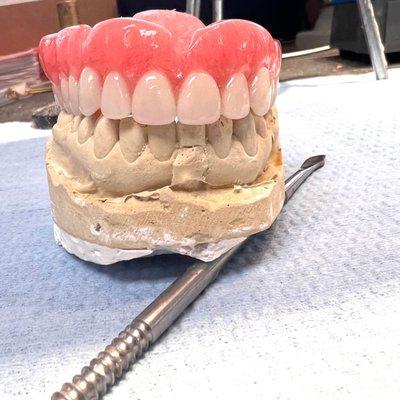 Premium Upper Denture