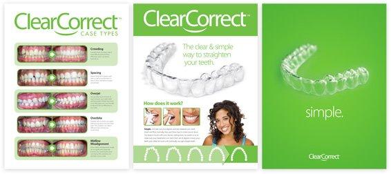 Clear braces to improve your smile!