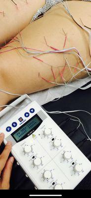 Electrical stimulation