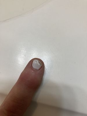 More horrible nail job