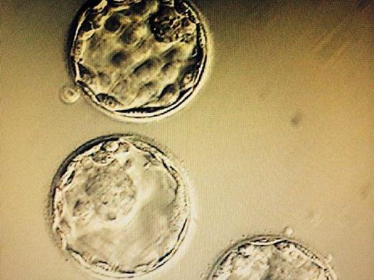 Healthy embryos :)