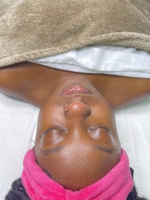 diamond facial