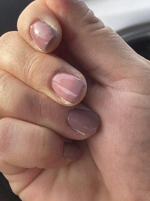 Dried cuticles