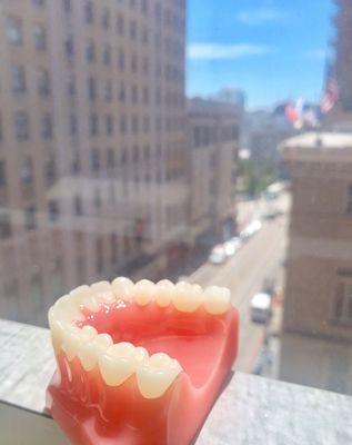 Perfect Teeth + Perfect SF Views at Dentistry of San Francisco, Dental Office.