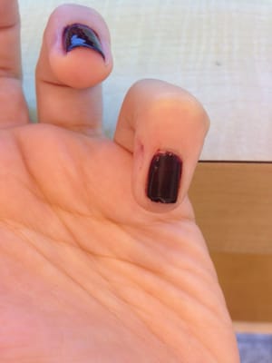 Cut, bad filing, paint everywhere. (Like this on every nail.)