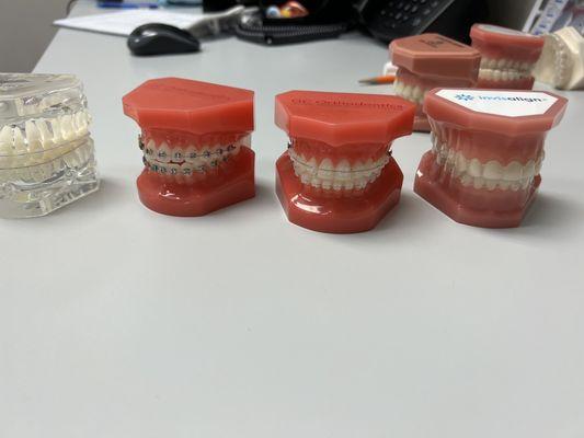 Braces options