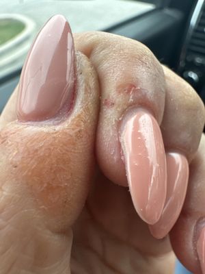 Terrible cuticles