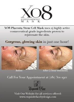 XO8 Placenta Stem Cell Mask