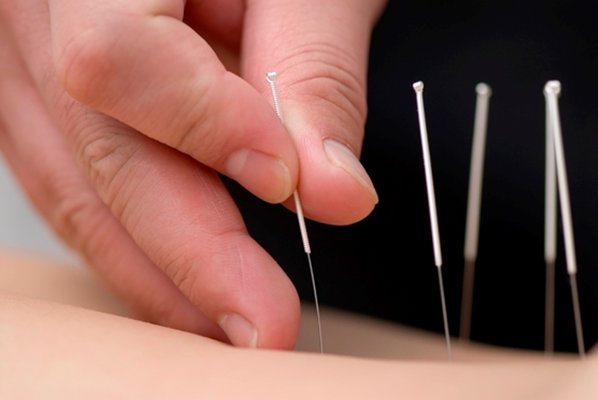 Giddings Acupuncture Practice