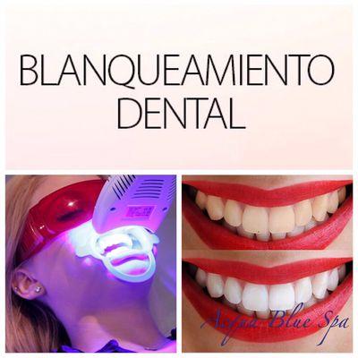 Blanqueamiento dental por tan solo $99.00