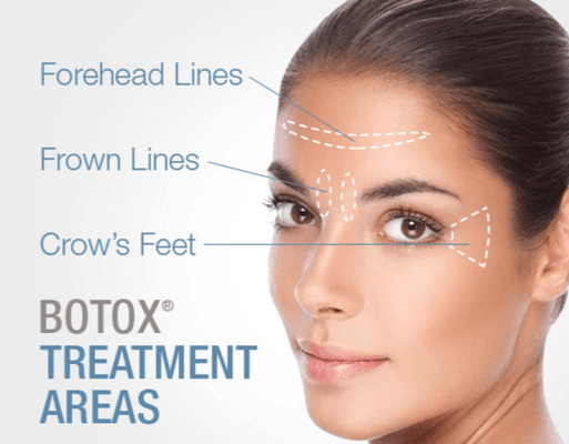 Botox Treatment for Wrinkles