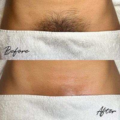 Brazilian Sugar | Before & After