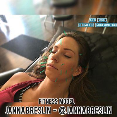 Treating Janna Breslin! On the cover of Fitness Magazine 4 times, 6 time bikini champion, and holistic health coach. @jannabreslin