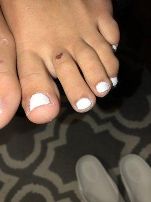 No caption needed you can clearly see the white all over the outsides or my toes. WORST PEDICURE.