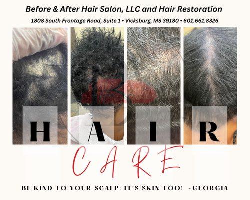 Scalp care is the new hair care!