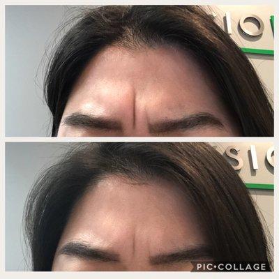 After 1 month (1-2 treatments/week).