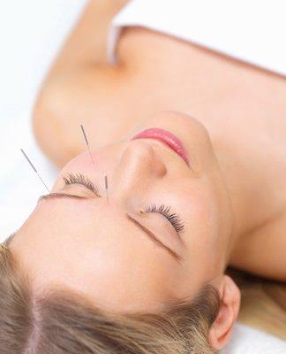 AcuRadiance's Non-Surgical Facial Rejuvenation  is considered as Modern Acupuncture Technique. Based on Oriental Medicine Theory, Acupunctur