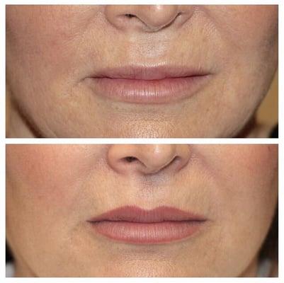 Before and after lips permanent makeup.