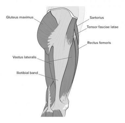 Myofascial tension and tight IT band can lead to referred pain in other areas.