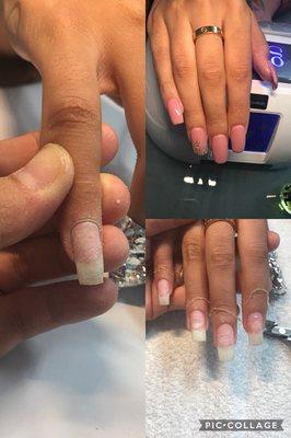 Acrylics soaked off correctly with an SNS overlay and gel polish on top