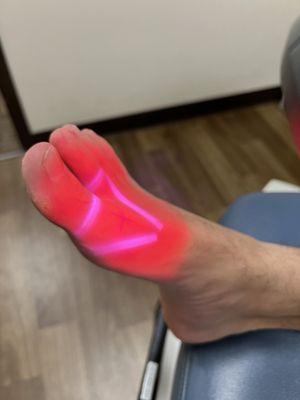 Robotic Laser is the future of pain relief