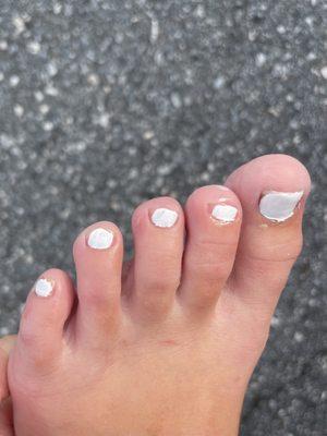 Unacceptable pedicure