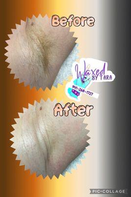 Underarm wax