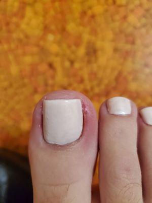 Awful pedicure that made me bleed